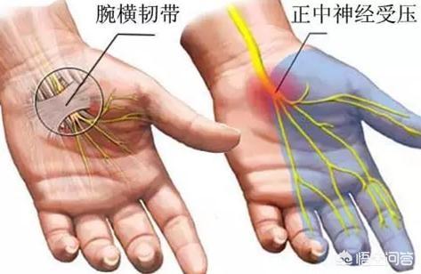 一直玩手机手指麻_手长时间玩手机发麻手指伸不直_玩手机游戏久了手指麻疼