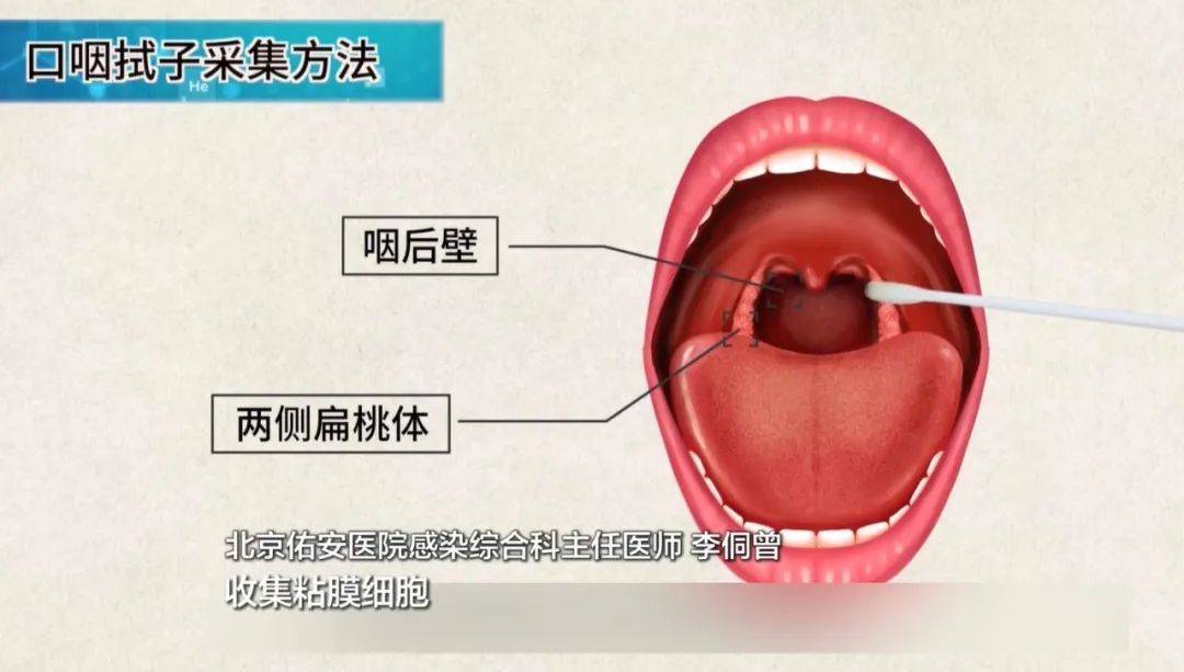 核酸检测信息暂未查询到数据_核酸信息查不到是什么原因_为查询到核酸检测结果